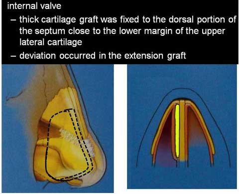 slide 19