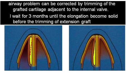 slide 22