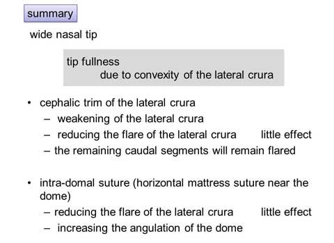 第101回 鼻尖縮小術：軟骨の処理英語スライド2