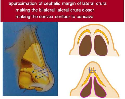 slide 109