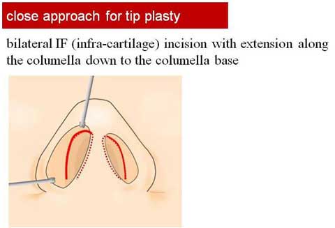 slide 111