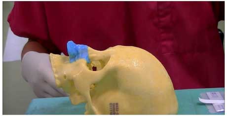 3D molding model-2