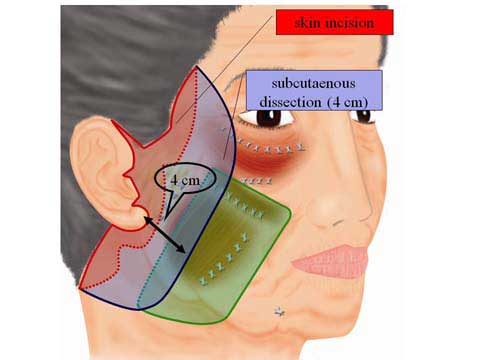 slide c-7