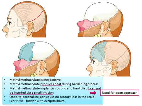 Lecture by the slide-12