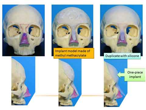 Lecture by the slide-13