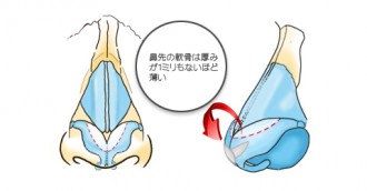 鼻尖形成