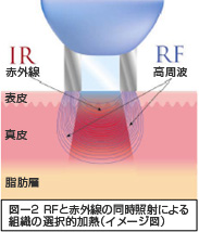 リファーム