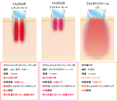 マトリックス
