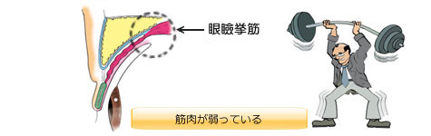 筋肉が弱っているタイプ