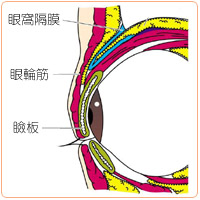 厚ぼったいまぶたの治療