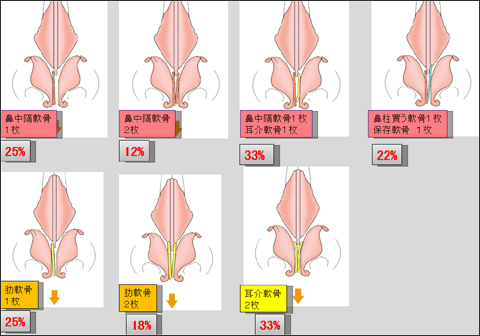 鼻尖や鼻柱の傾き・鼻孔の左右差の発生頻度