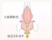 正常な延長