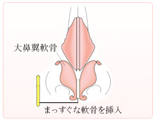 まっすぐな軟骨