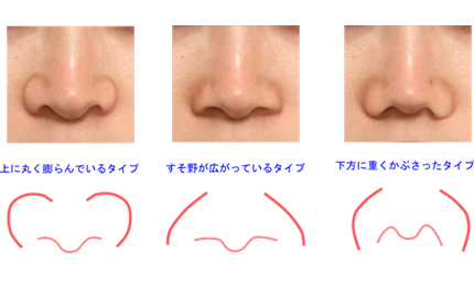 鼻翼は非常に複雑な立体構造をしています