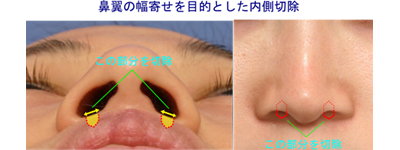 自然な幅寄せが可能