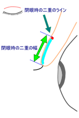 閉眼時の二重の幅