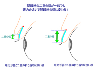 二重の幅の差