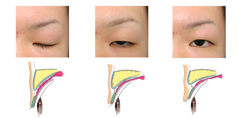 一重まぶたのメカニズム