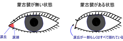 目頭部分の解剖