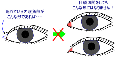 目頭部分の解剖