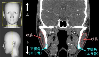 前方、中間、後方の垂直断面