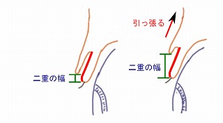 まぶたを引っ張る