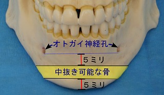 オトガイ神経