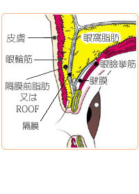 上まぶたの浅いところにある脂肪