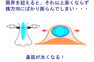 ヒアルロン酸