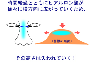 ヒアルロン酸