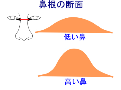 鼻根の断面