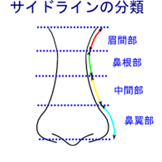 鼻のサイドライン分類