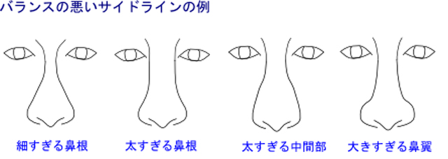 バランスの悪いサイドライン