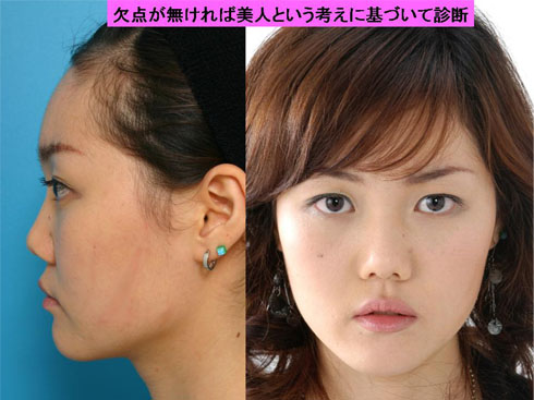 欠点の認識