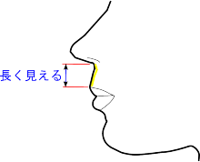 長い鼻下を短くするには 美容整形 美容外科のヴェリテクリニック 公式 東京 名古屋 大阪