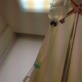 高濃度ビタミンC点滴