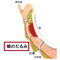 フェイスリフト