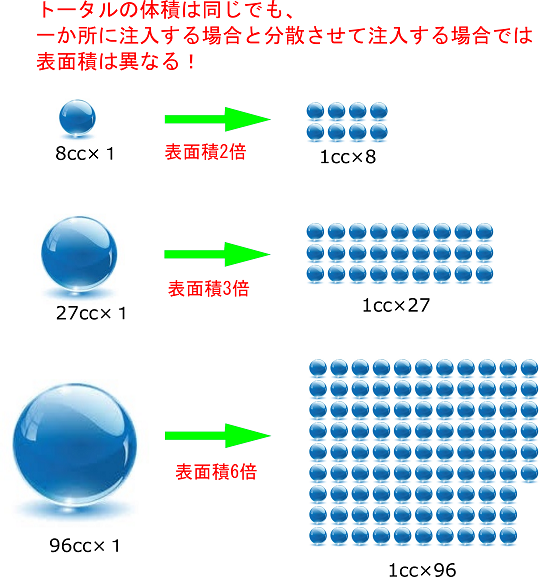 豊胸術