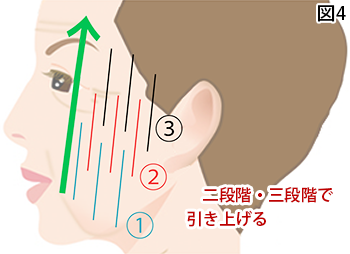 二段階・三段階で引き上げます