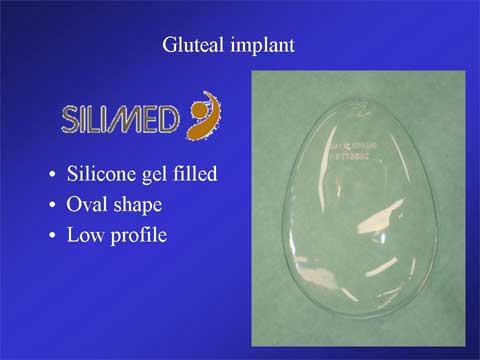 SILIMED社のスムースタイプのシリコンジェル