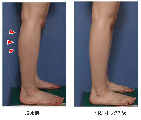 細く を 筋肉質 方法 する な 足