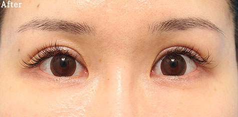 after