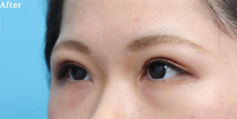 after