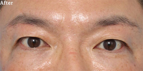 after