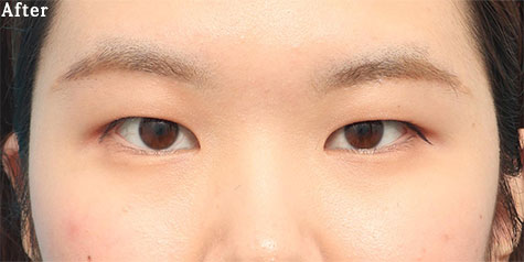 after