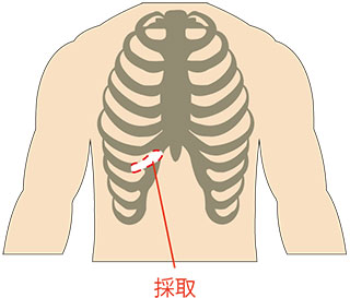 鼻中隔延長術