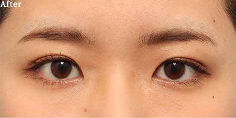 after