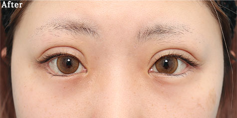 after