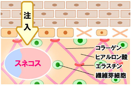 ヒアルロン酸とアミノ酸