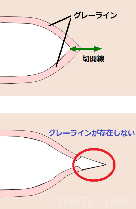 グレーラインが存在しない